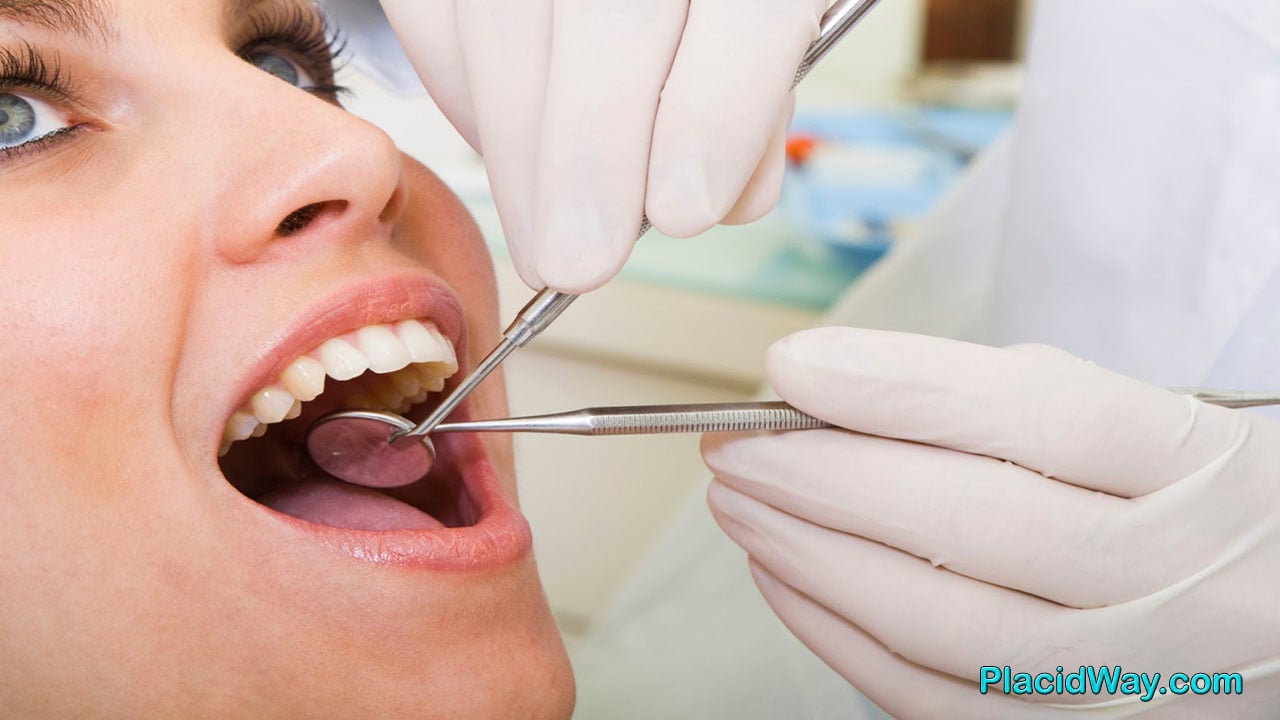 Benefits Of Choosing Dental Implants